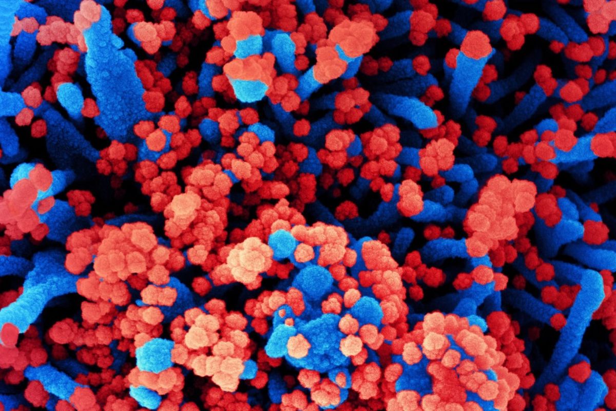 Micrografía electrónica de barrido de células humanas (azul) infectadas con SARS-CoV-2 (rojo). Foto: CSIC. 
